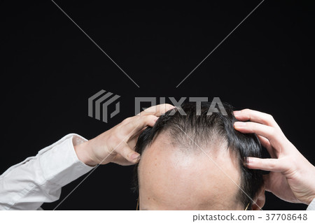 Middle men thin hair Middle men thin hair 37708648