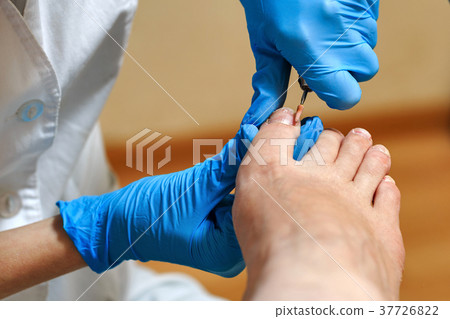 Chiropody 37726822