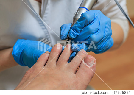 Chiropody 37726835