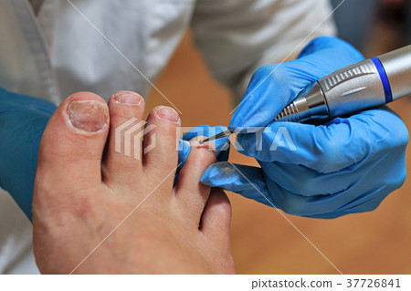 Chiropody 37726841
