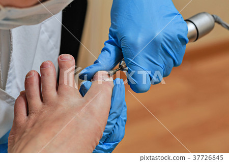 Chiropody 37726845