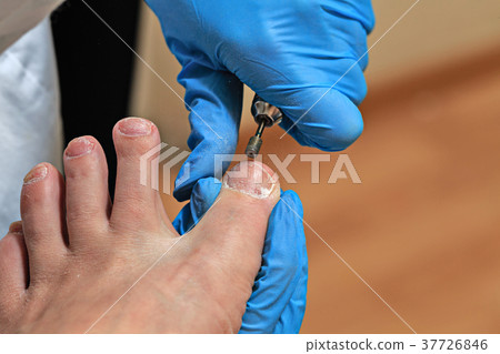 Chiropody 37726846