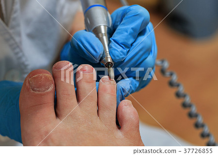 Chiropody Chiropody 37726855