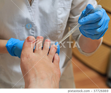 Chiropody 37726869