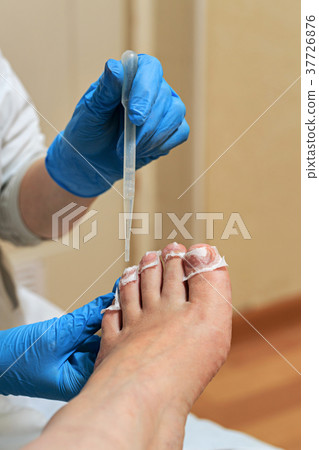 Chiropody 37726876