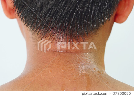 Sweat on the neck Sweat on the neck 37800090