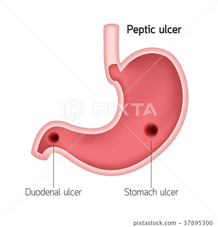 Cross section of human stomach. Cross section of human stomach. 37895300
