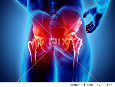 Hip painful skeleton x-ray, 3D illustration. 37999166