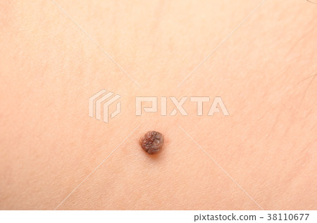 mole mole 38110677