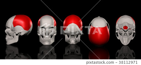 頂骨定位列表 38112971