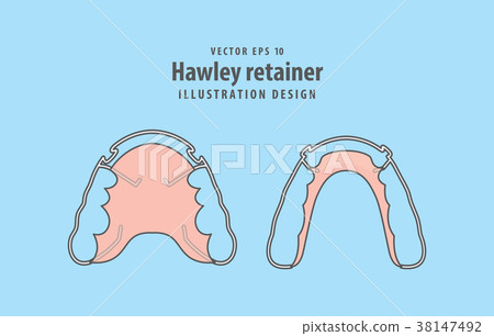 Hawley retainer illustration vector Dental concept Hawley retainer illustration vector Dental concept 38147492