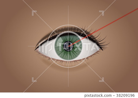 Vision correction by a laser beam. Vision correction by a laser beam. 38209196
