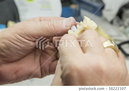 Dental Technician Works On 3D Mold Tooth Implants 38222107