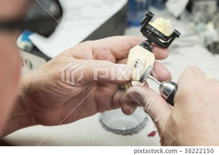 Dental Technician Works On 3D Mold Tooth Implants 38222150