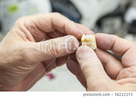 Dental Technician Works On 3D Mold Tooth Implants 38222153