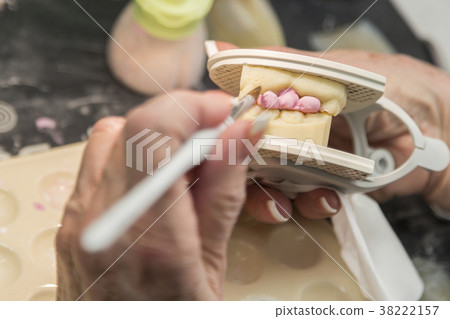 Dental Technician Works On 3D Mold Tooth Implants 38222157