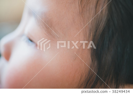 temple, hairline, younger 38249434