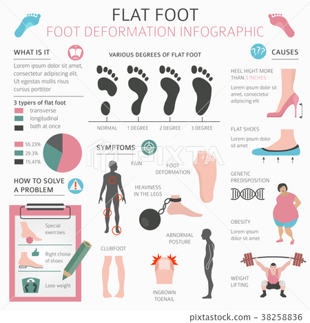 Foot deformation flat foot medical infographic Foot deformation flat foot medical infographic 38258836