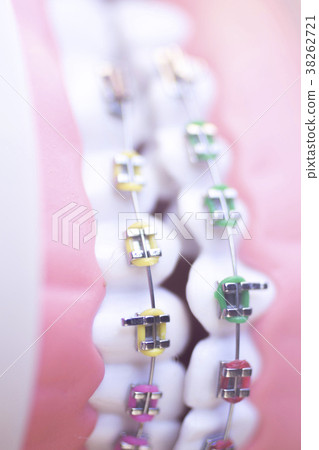 Cosmetic dental metal brackets 38262721