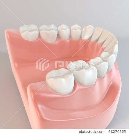 Tooth 38270865