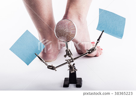 dehydrated skin on the heels of female feet 38365223