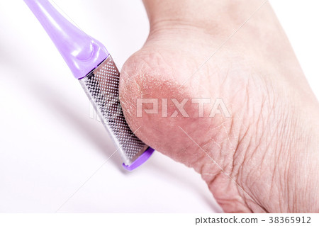 female legs with overdried dehydrated dry skin on 38365912