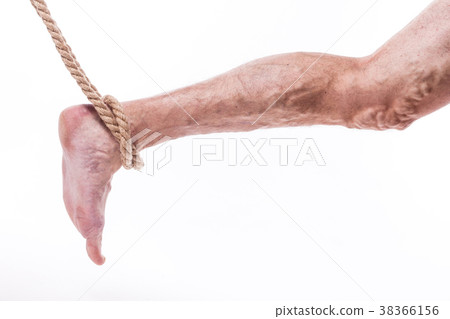 rope holding human leg ailing varicose veins of 38366156