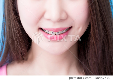 close up woman wear brace close up woman wear brace 38437370