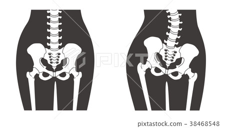 Human skeleton _ waist _ skin color 38468548