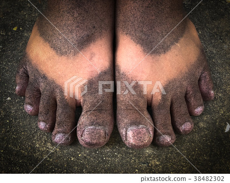 Black spray on the feet. 38482302