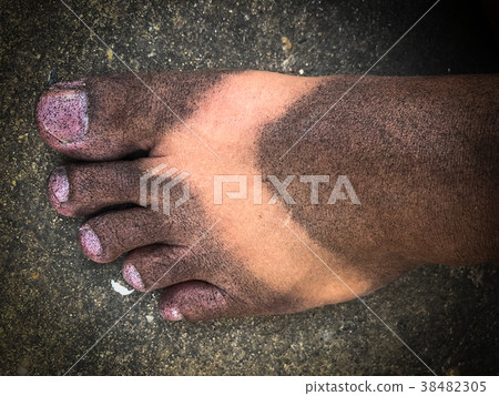 Black spray on the feet. 38482305