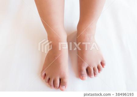 Hand-foot-and-mouth disease  38496193
