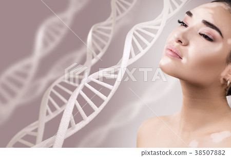 Young sensual woman with vitiligo in DNA chains. 38507882