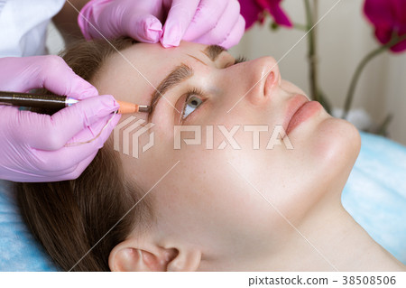 Permanent microblasting tattooing freckles to a Permanent microblasting tattooing freckles to a 38508506
