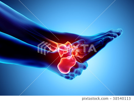 Ankle painful - skeleton x-ray. Ankle painful - skeleton x-ray. 38540113
