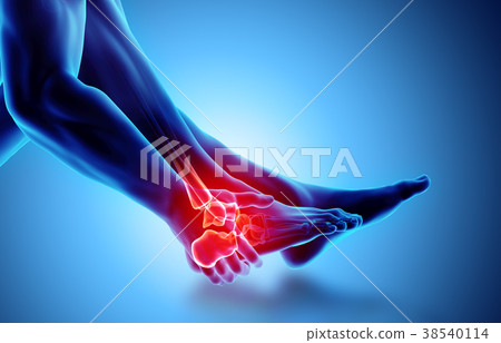 Ankle painful - skeleton x-ray. 38540114