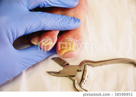 Pedicurist hands in  sterile gloves cut nails 38590951