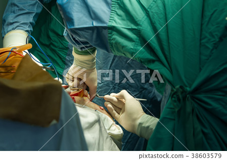 Operation of trepanation of the skull. Operation of trepanation of the skull. 38603579