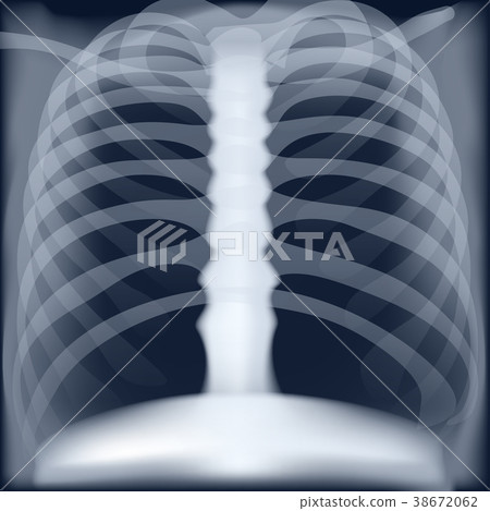 xray medical image of chest xray medical image of chest 38672062