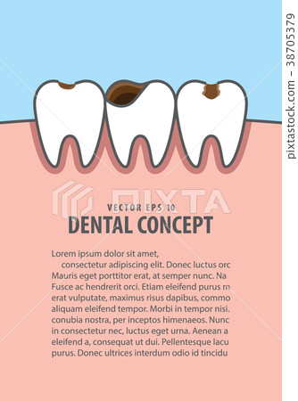 Layout Caries and cavity teeth illustration vector Layout Caries and cavity teeth illustration vector 38705379