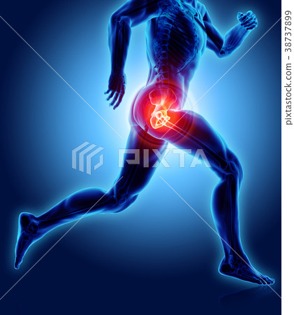 Hip painful skeleton x-ray, 3D illustration. 38737899