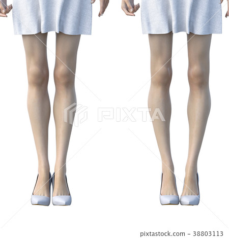 O leg women comparison perming3DCG illustrations material O leg women comparison perming3DCG illustrations material 38803113