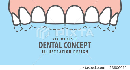 Banner Upper attrition (Bruxism) teeth vector Banner Upper attrition (Bruxism) teeth vector 38806011