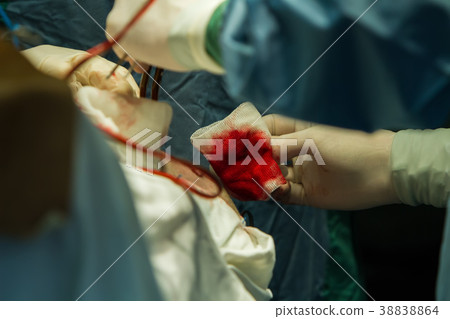 Operation of trepanation of the skull. 38838864