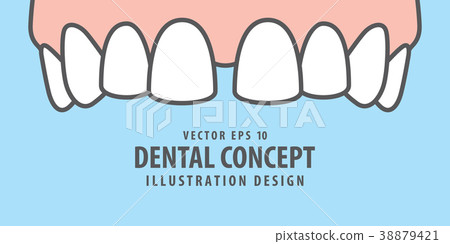 Banner Upper Diastema teeth illustration vector Banner Upper Diastema teeth illustration vector 38879421
