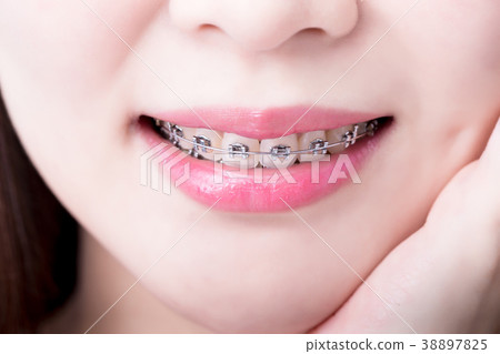 close up woman wear brace close up woman wear brace 38897825