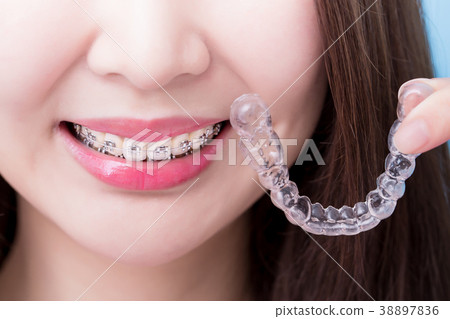 woman take invisible braces 38897836