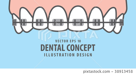 Banner Upper Braces teeth illustration vector Banner Upper Braces teeth illustration vector 38913458