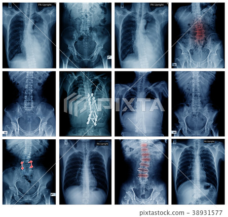 big collection of x-ray 38931577