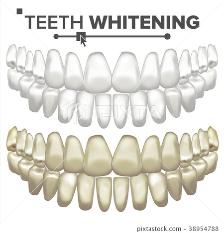 Teeth Whitening Vector. Dental Care. Cleaning Teeth Whitening Vector. Dental Care. Cleaning 38954788
